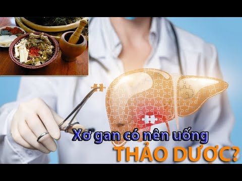 Dấu hiệu cho thấy bạn bị xơ gan