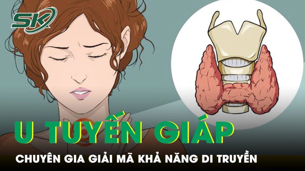 U Tuyến Giáp – Chuyên Gia Giải Mã Vấn Đề Di Truyền | SKĐS