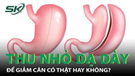 Thực Hư Chuyện Phẫu Thuật Thu Nhỏ Dạ Dày Để Giảm Cân I SKĐS